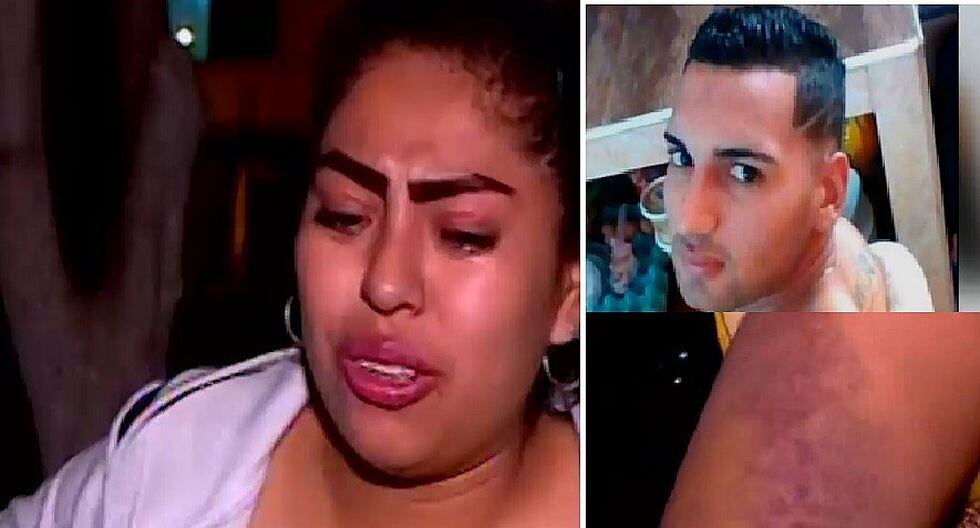 Mujer es agredida por su expareja tras terminar relación y fiscalía lo deja libre (VIDEO)