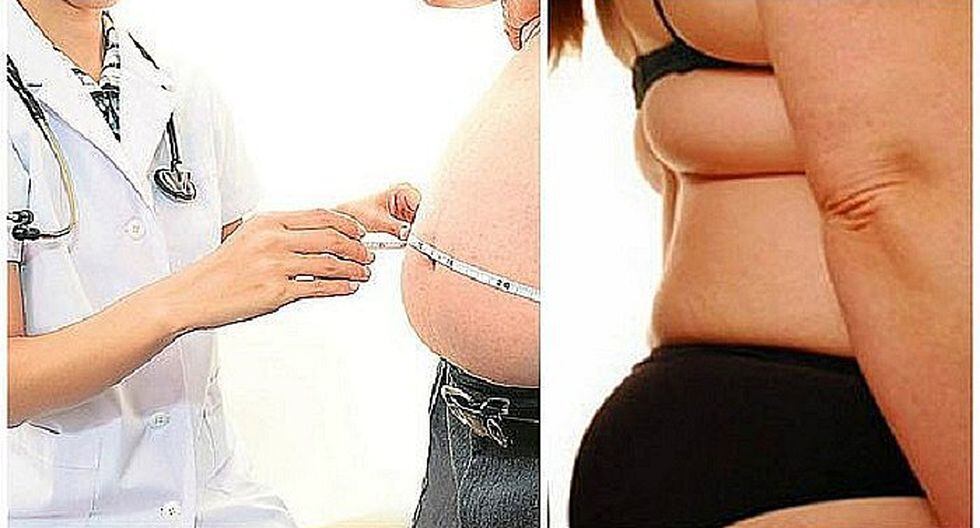 Unos 14 millones de peruanos mayores de 15 años sufren de sobrepeso u obesidad