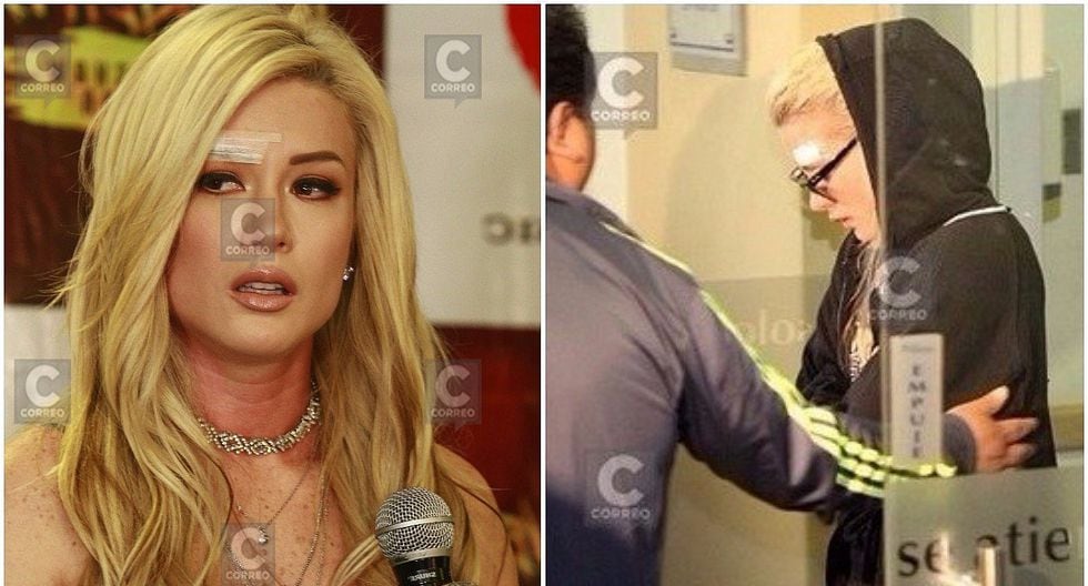 Leslie Shaw impacta mostrando herida en Facebook tras asalto y preocupa a fans (FOTOS)