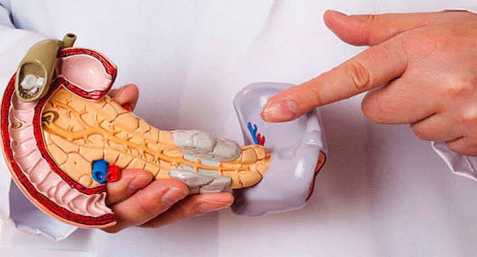 Dos mil peruanos fallecen al año por padecer cáncer de páncreas