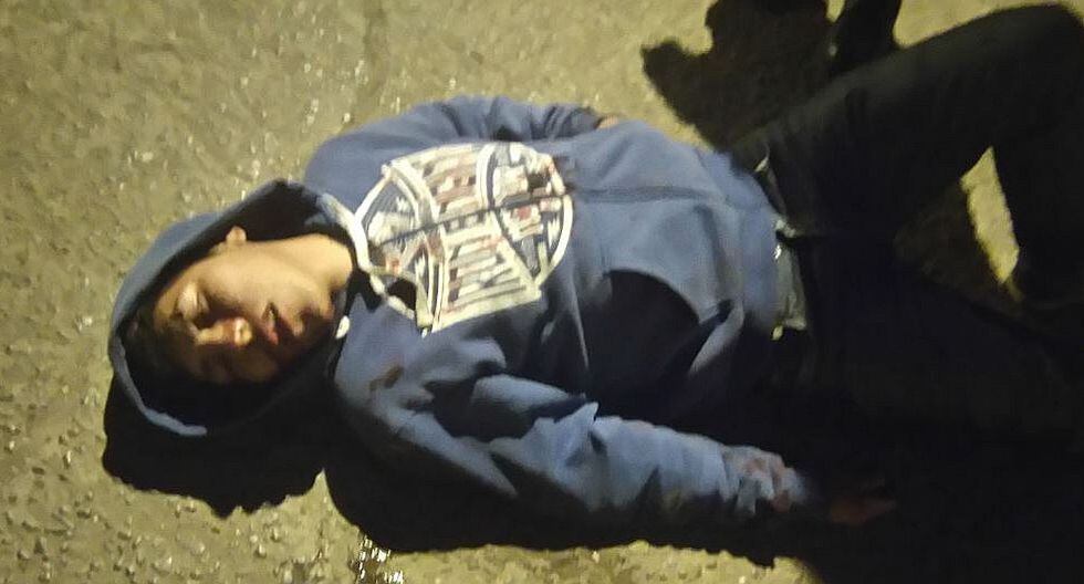 JULIACA: ladrones le dejaron enorme corte a joven que se resistió a asalto